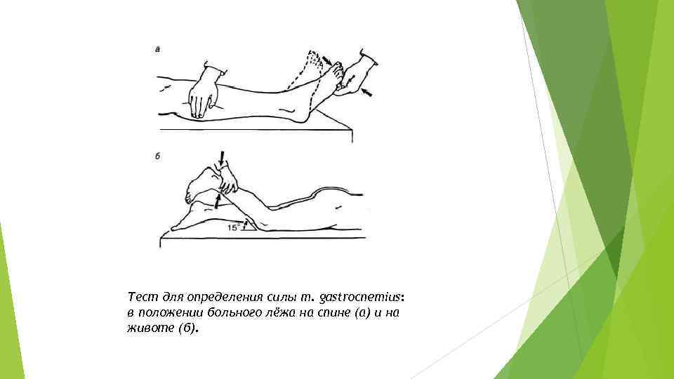 Тест для определения силы m. gastrocnemius: в положении больного лёжа на спине (а) и