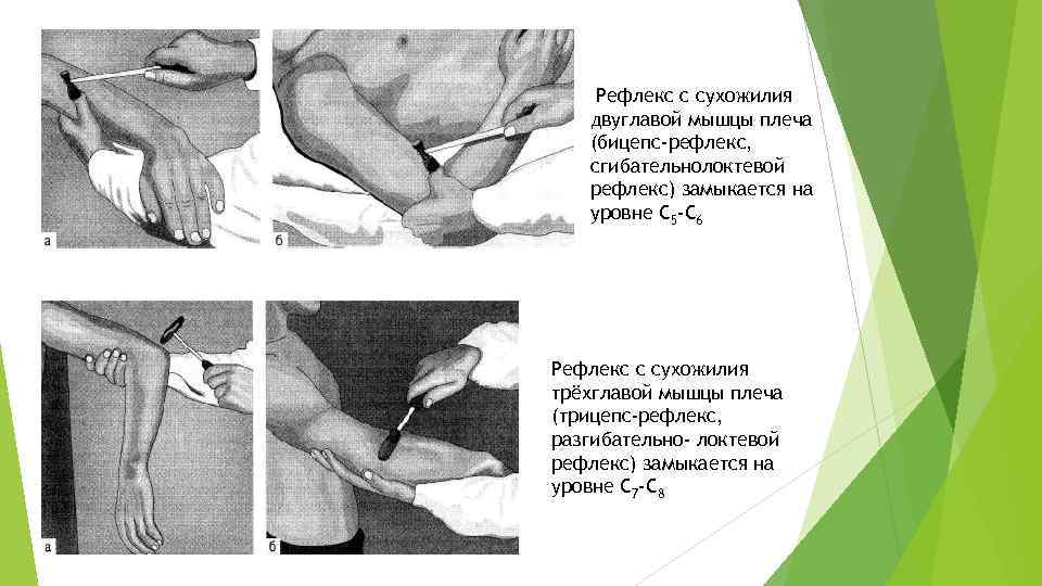  Рефлекс с сухожилия двуглавой мышцы плеча (бицепс-рефлекс, сгибательнолоктевой рефлекс) замыкается на уровне C