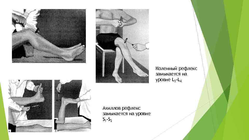 Коленный рефлекс замыкается на уровне L 3 -L 4 Ахиллов рефлекс замыкается на уровне