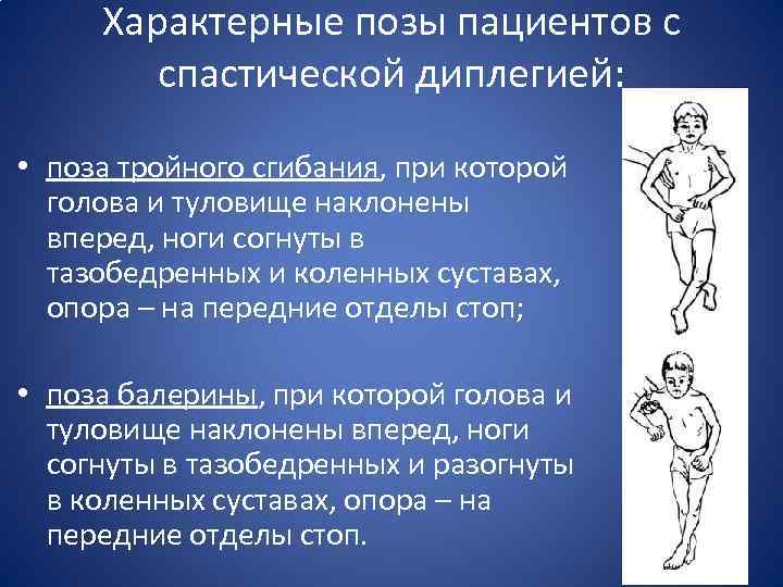 Характерные позы пациентов с спастической диплегией: • поза тройного сгибания, при которой голова и