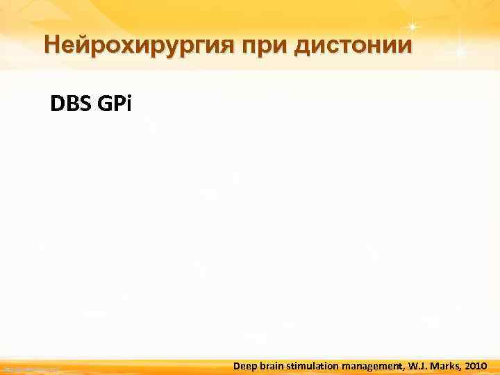 Нейрохирургия при дистонии DBS GPi http: //linda 6035. ucoz. ru/ Deep brain stimulation management,