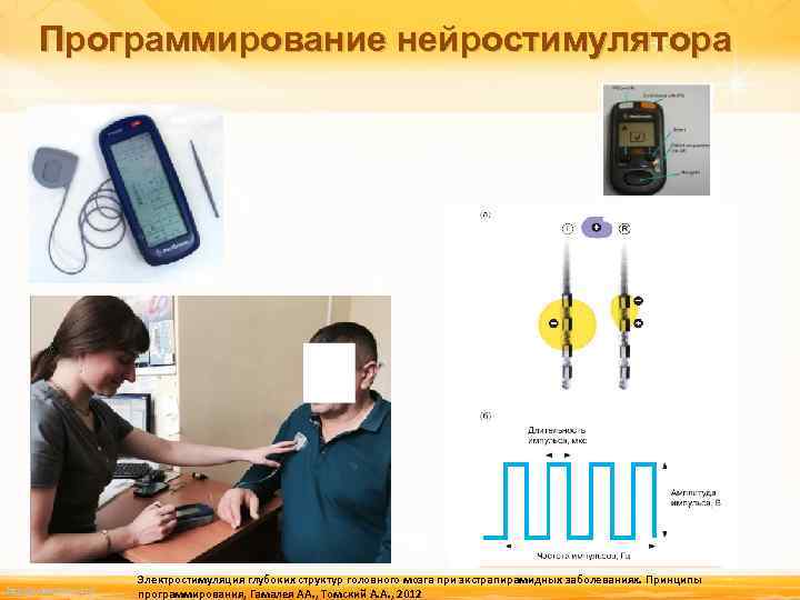 Программирование нейростимулятора http: //linda 6035. ucoz. ru/ Электростимуляция глубоких структур головного мозга при экстрапирамидных