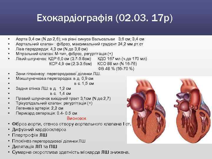 Ехокардіографія (02. 03. 17 р) • • • • Аорта 3, 4 см (N