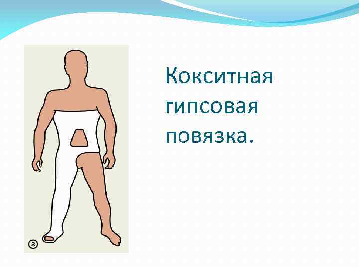 Кокситная гипсовая повязка. 