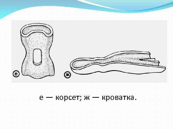 е — корсет; ж — кроватка. 