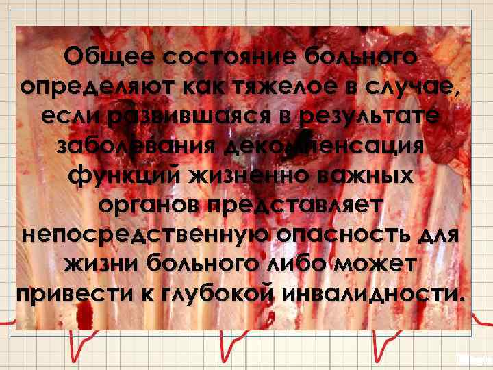 Общее состояние больного определяют как тяжелое в случае, если развившаяся в результате заболевания декомпенсация