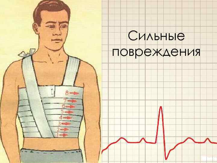 Сильные повреждения 