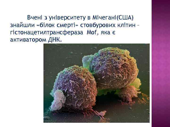 Вчені з університету в Мічегані(США) знайшли «білок смерті» стовбурових клітин – гістонацетилтрансфераза Mof, яка