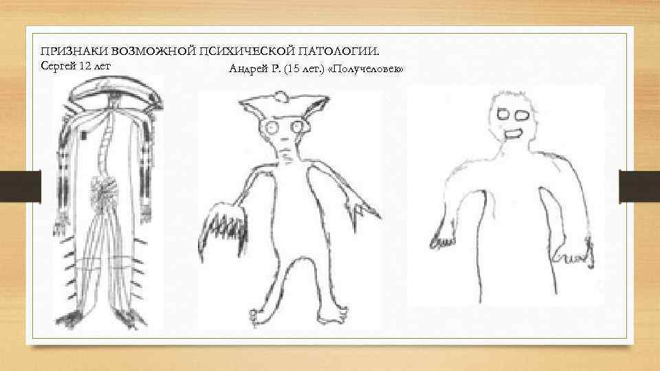 ПРИЗНАКИ ВОЗМОЖНОЙ ПСИХИЧЕСКОЙ ПАТОЛОГИИ. Сергей 12 лет Андрей Р. (15 лет. ) «Получеловек» 