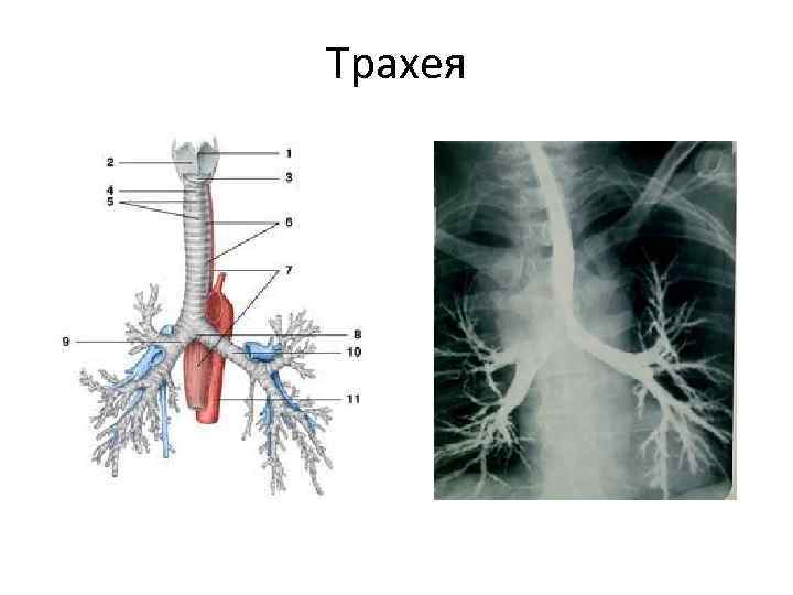 Трахея и бронхи. Бифуркация трахеи анатомия. Бифуркация трахеи топография. Трахея бифуркация трахеи бронхи. Трахея бифуркация трахеи строение стенки.