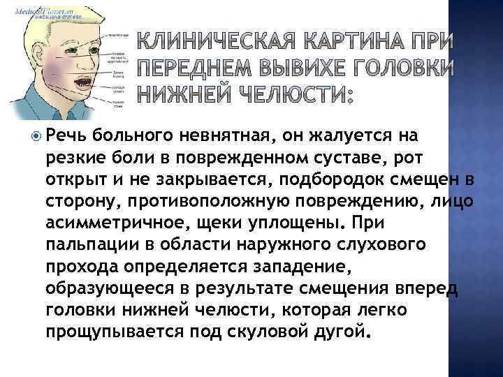  Речь больного невнятная, он жалуется на резкие боли в поврежденном суставе, рот открыт