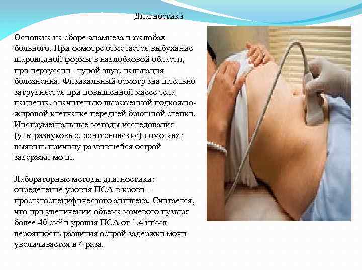  Диагностика Основана на сборе анамнеза и жалобах больного. При осмотре отмечается выбухание шаровидной