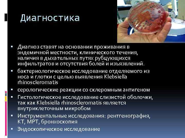 Диагностика Диагноз ставят на основании проживания в эндемичной местности, клинического течения, наличия в дыхательных