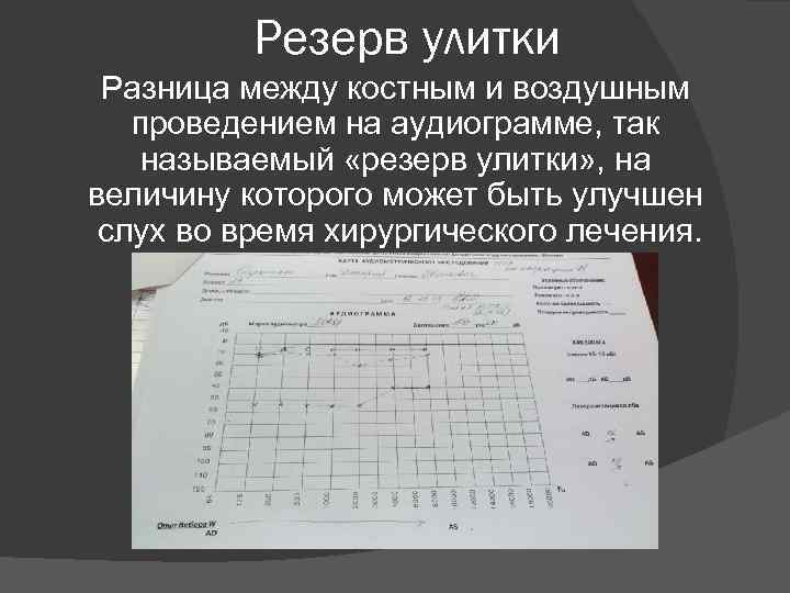 Резерв улитки Разница между костным и воздушным проведением на аудиограмме, так называемый «резерв улитки»