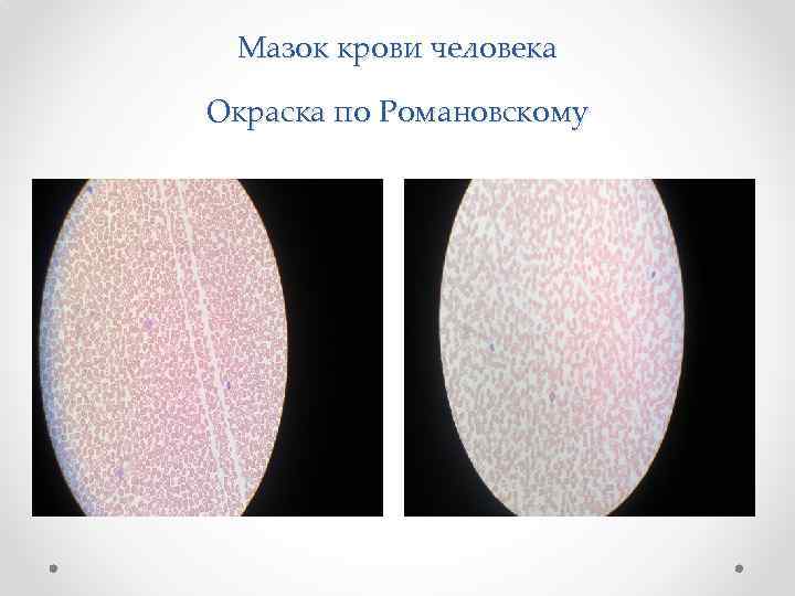 Мазок крови человека Окраска по Романовскому 