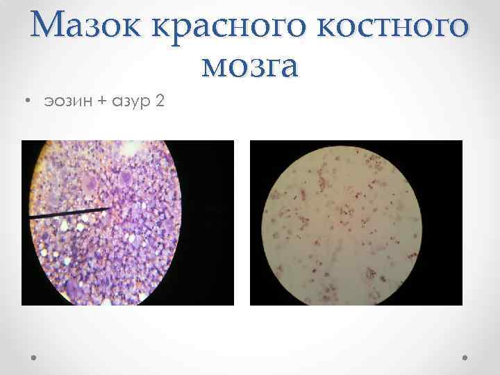 Мазок красного костного мозга • эозин + азур 2 