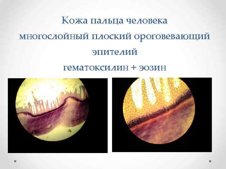 Кожа пальца человека многослойный плоский ороговевающий эпителий гематоксилин + эозин 