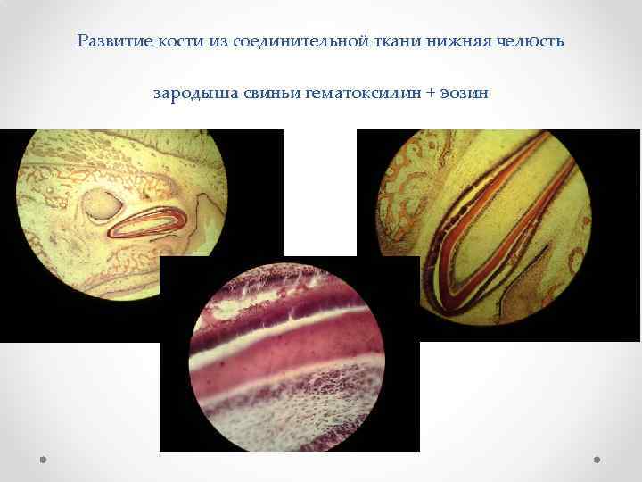 Развитие кости из соединительной ткани нижняя челюсть зародыша свиньи гематоксилин + эозин 