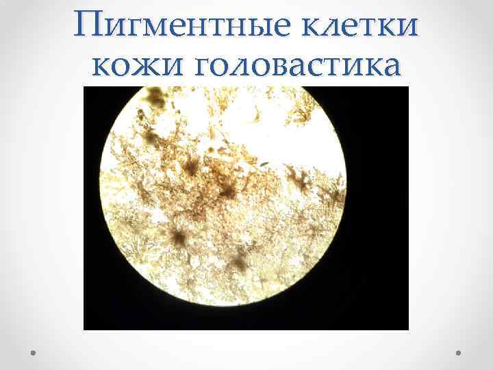 Пигментные клетки кожи головастика 