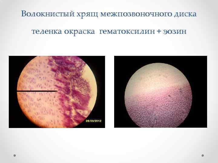Волокнистый хрящ межпозвоночного диска теленка окраска гематоксилин + эозин 