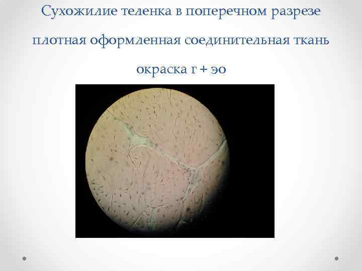 Сухожилие теленка в поперечном разрезе плотная оформленная соединительная ткань окраска г + эо 