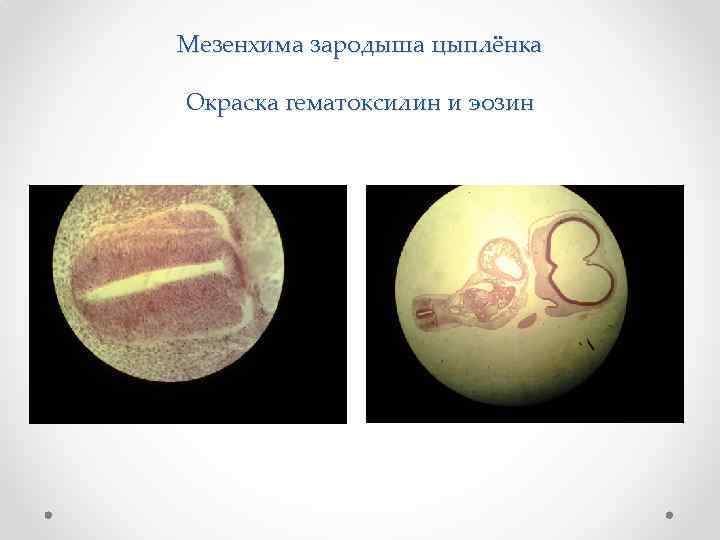 Мезенхима зародыша цыплёнка Окраска гематоксилин и эозин 