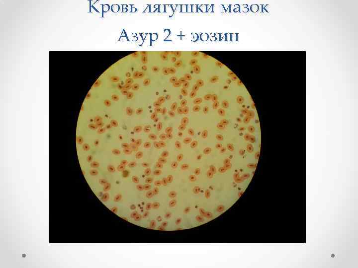 Кровь лягушки мазок Азур 2 + эозин 