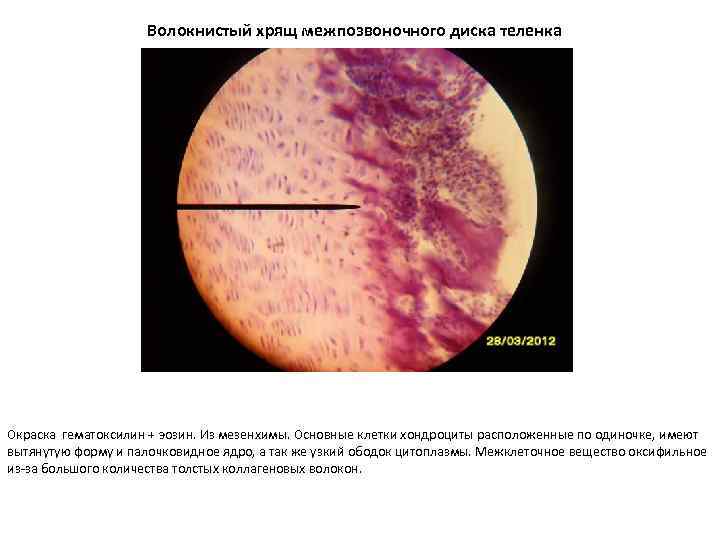 Волокнистый хрящ межпозвоночного диска теленка Окраска гематоксилин + эозин. Из мезенхимы. Основные клетки хондроциты