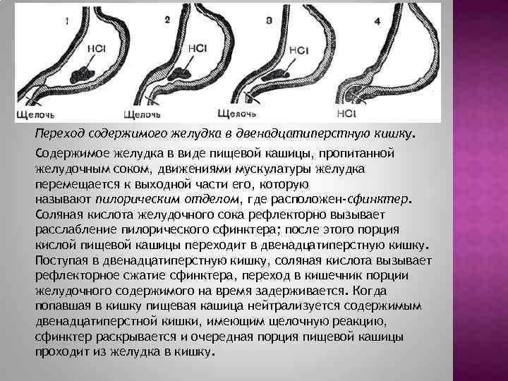 Переход содержимого желудка в двенадцатиперстную кишку. Содержимое желудка в виде пищевой кашицы, пропитанной желудочным