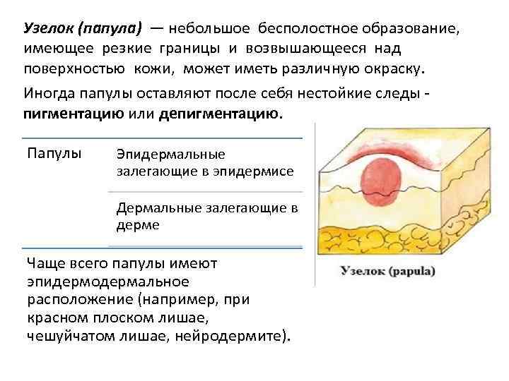 Наружная терапия в дерматологии схема