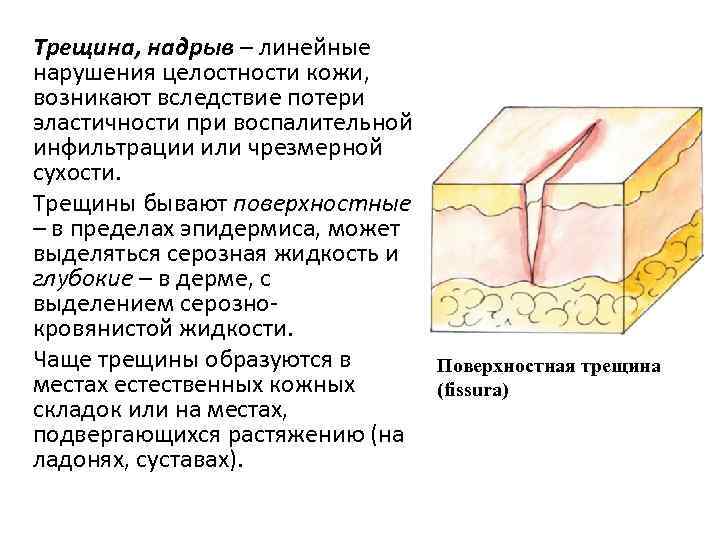 Наружная терапия в дерматологии схема