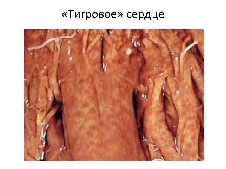  «Тигровое» сердце 