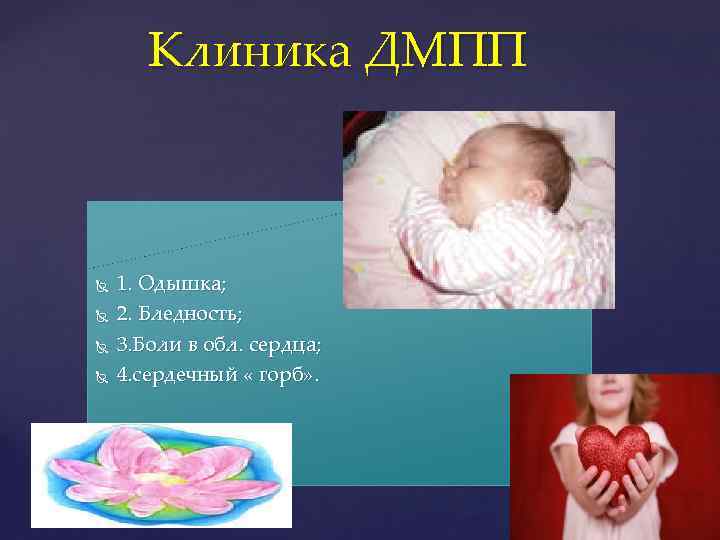 Клиника ДМПП 1. Одышка; 2. Бледность; 3. Боли в обл. сердца; 4. сердечный «