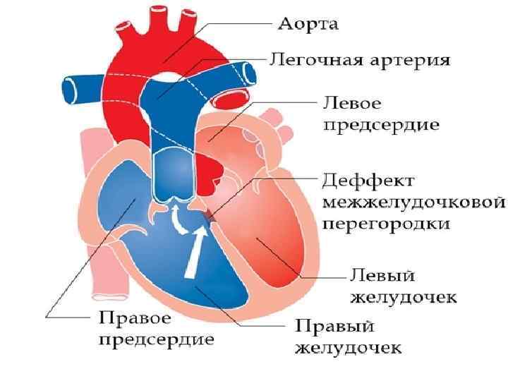 Правое предсердие аорта левый желудочек легкие левое. Правый желудочек и легочная артерия. Строение межжелудочковой перегородки сердца. Строение сердца легочная артерия. Левая легочная артерия.