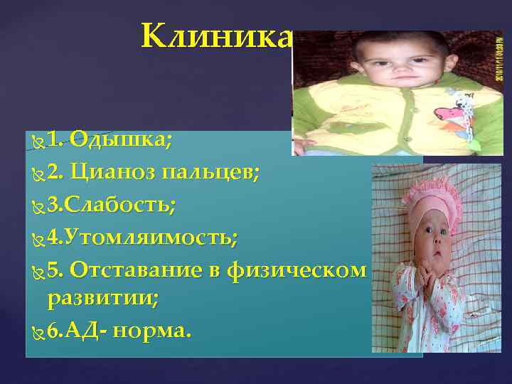 Клиника 1. Одышка; 2. Цианоз пальцев; 3. Слабость; 4. Утомляимость; 5. Отставание в физическом