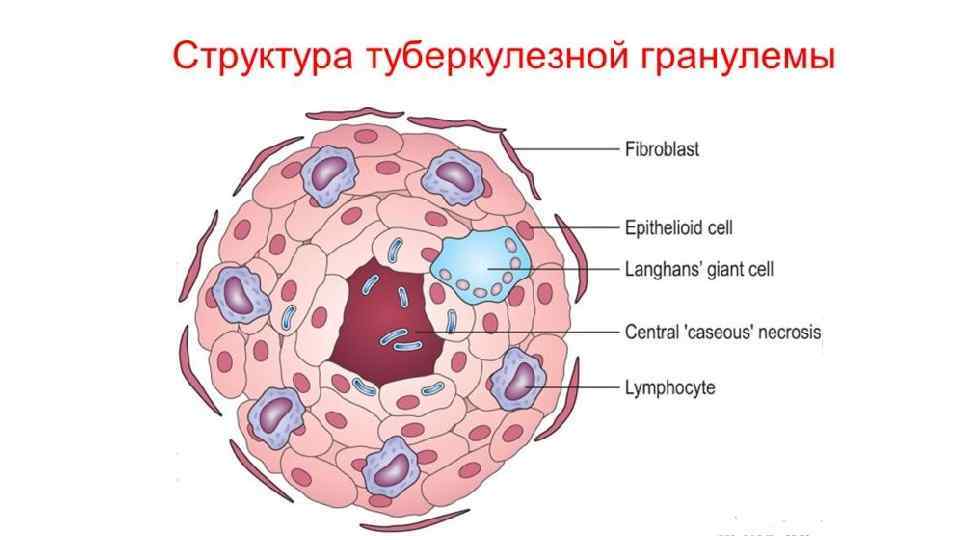 Продуктивное и экссудативное воспаление