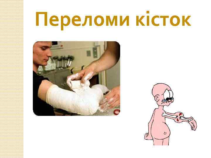 Переломи кісток 