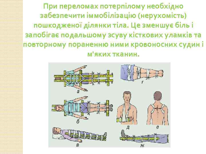 При переломах потерпілому необхідно забезпечити іммобілізацію (нерухомість) пошкодженої ділянки тіла. Це зменшує біль і