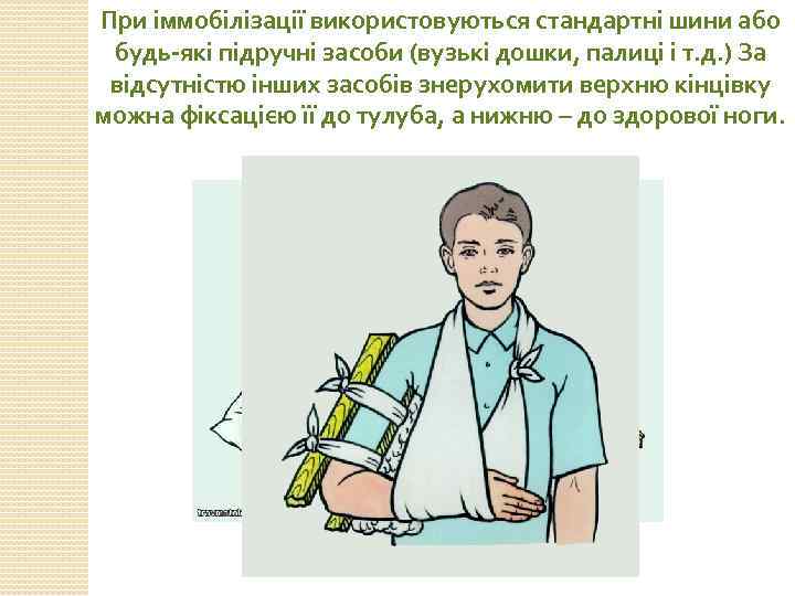 При іммобілізації використовуються стандартні шини або будь-які підручні засоби (вузькі дошки, палиці і т.