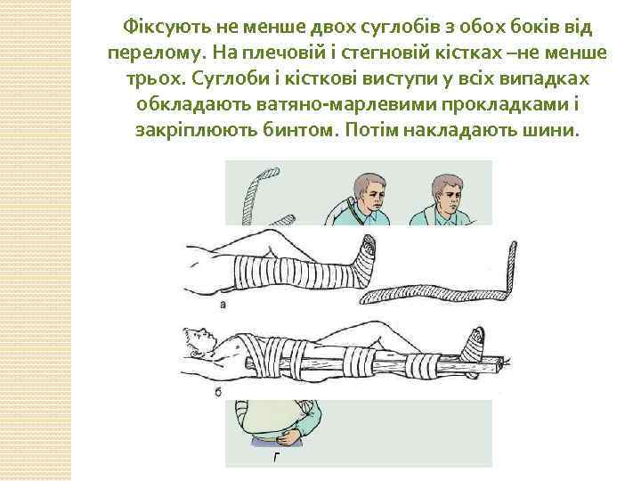 Фіксують не менше двох суглобів з обох боків від перелому. На плечовій і стегновій