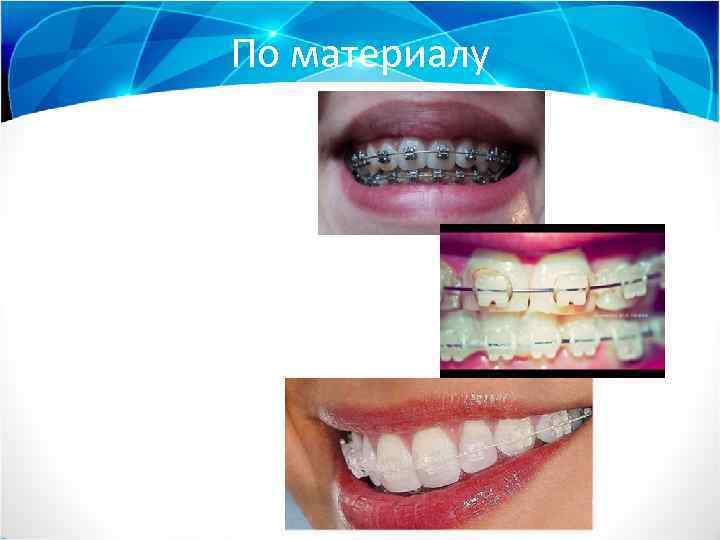 По материалу 