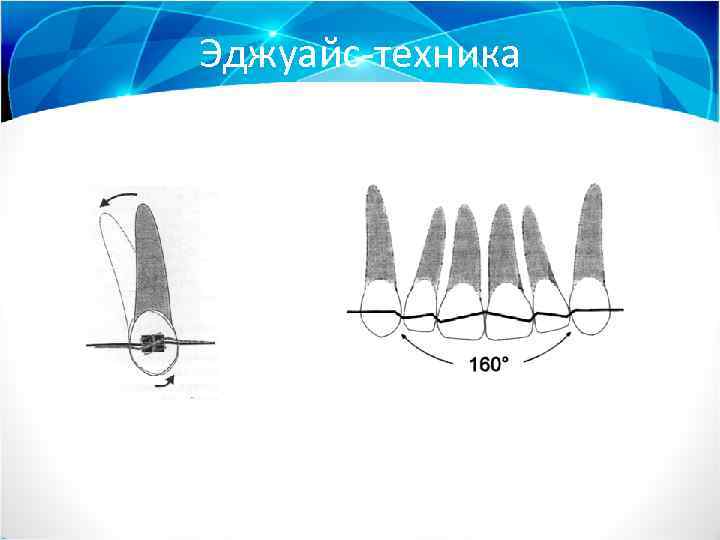Эджуайс-техника 