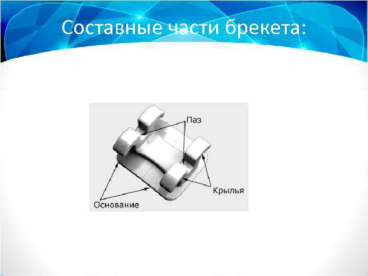 Составные части брекета: 