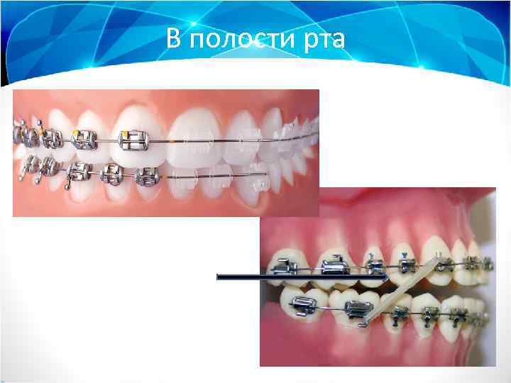 В полости рта 