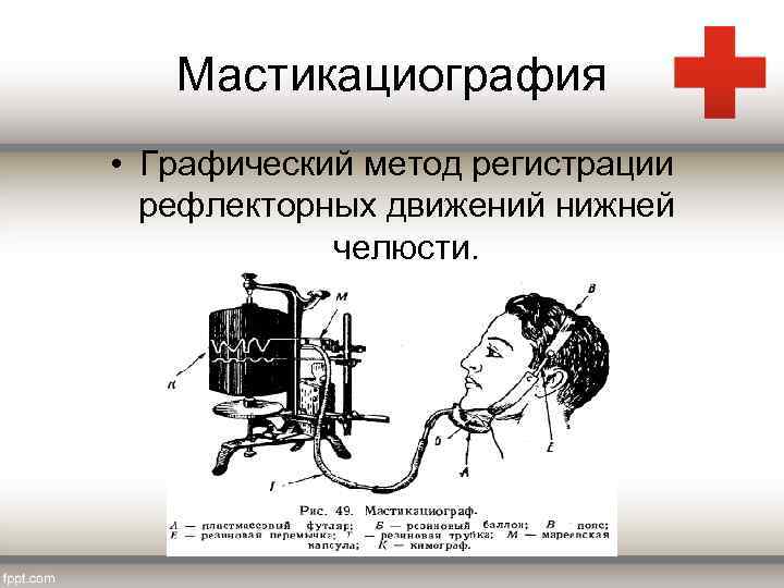 Мастикациография • Графический метод регистрации рефлекторных движений нижней челюсти. 