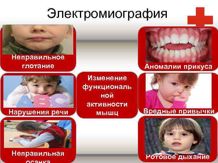 Электромиография Неправильное глотание Нарушения речи Неправильная Аномалии прикуса Изменение функциональ ной активности мышц Вредные