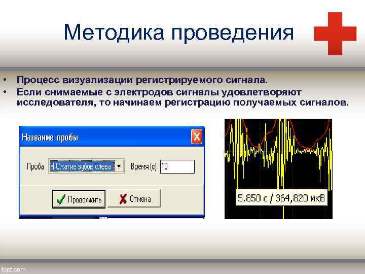 Методика проведения • Процесс визуализации регистрируемого сигнала. • Если снимаемые с электродов сигналы удовлетворяют