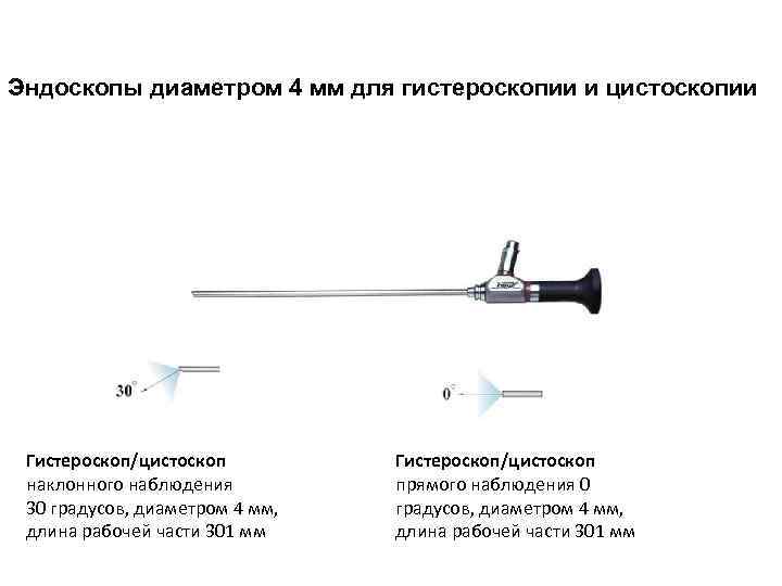 Протокол описание цистоскопии образец