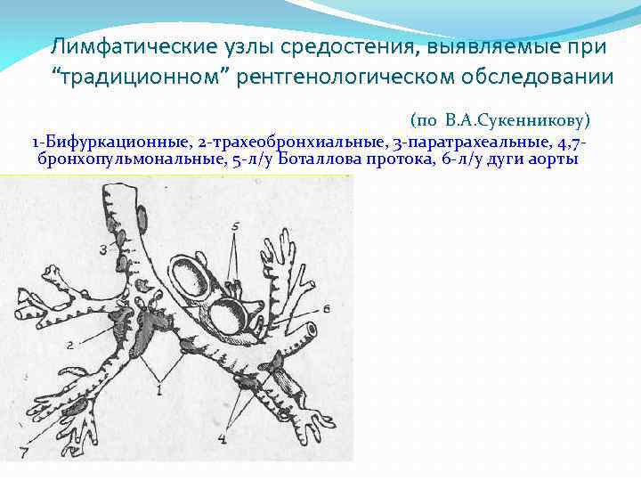 Лимфатические узлы средостения, выявляемые при “традиционном” рентгенологическом обследовании (по В. А. Сукенникову) 1 -Бифуркационные,