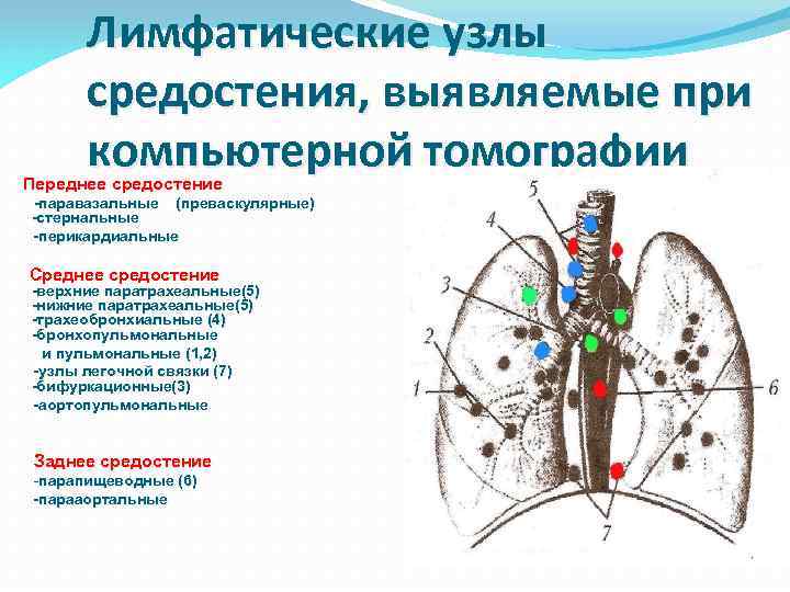 Лимфатические узлы средостения, выявляемые при компьютерной томографии Переднее средостение -паравазальные (преваскулярные) -стернальные -перикардиальные Среднее